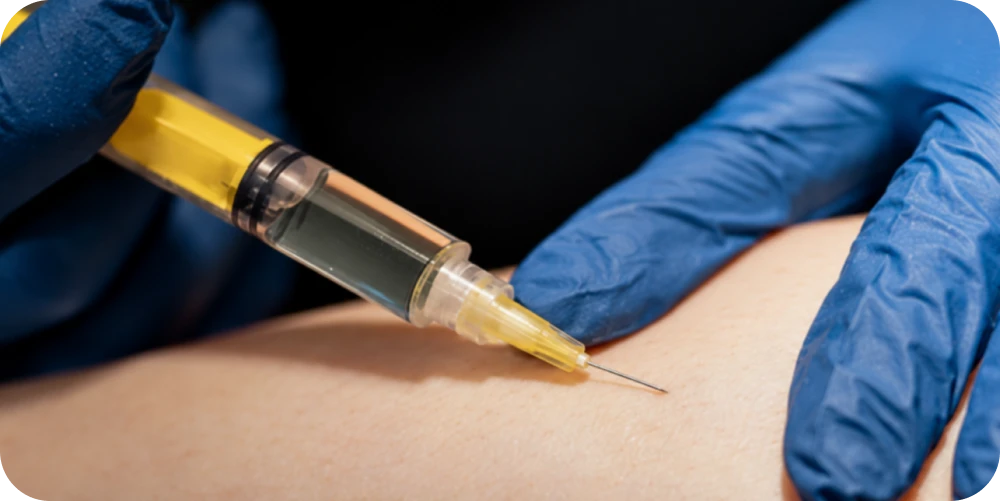 Escleroterapia